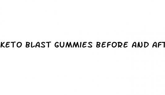 keto blast gummies before and after