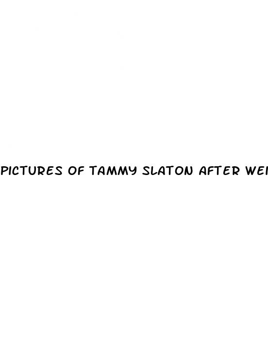 pictures of tammy slaton after weight loss