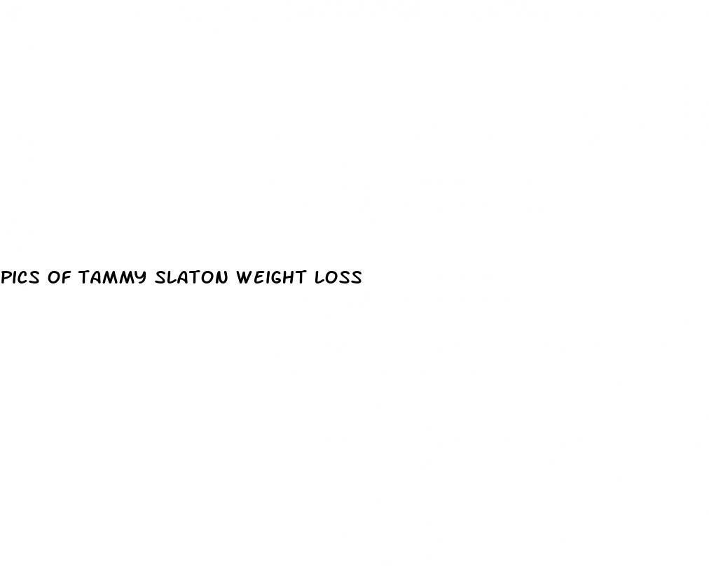 pics of tammy slaton weight loss