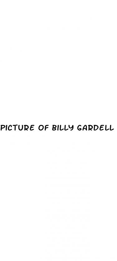 picture of billy gardell after weight loss