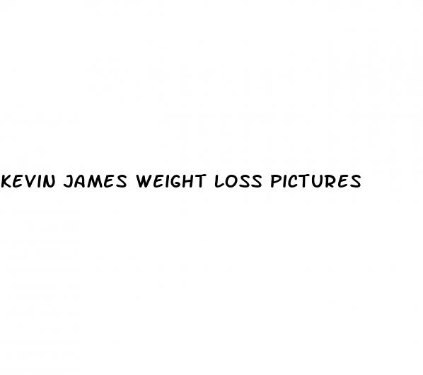 kevin james weight loss pictures