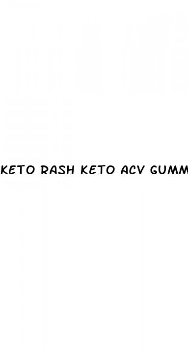 keto rash keto acv gummies