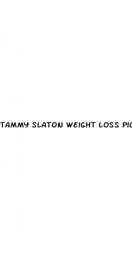 tammy slaton weight loss pictures