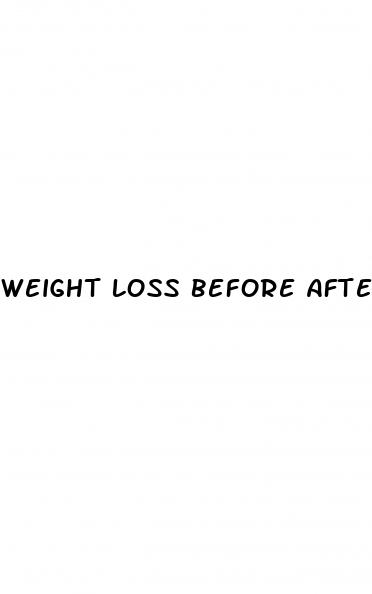 weight loss before after