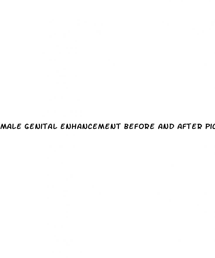 male genital enhancement before and after pictures