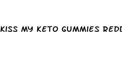 kiss my keto gummies reddit