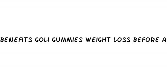 benefits goli gummies weight loss before and after