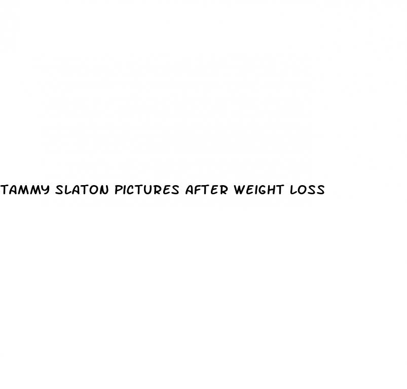 tammy slaton pictures after weight loss