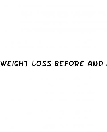 weight loss before and after