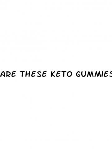 are these keto gummies for real