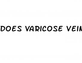 does varicose veins cause erectile dysfunction