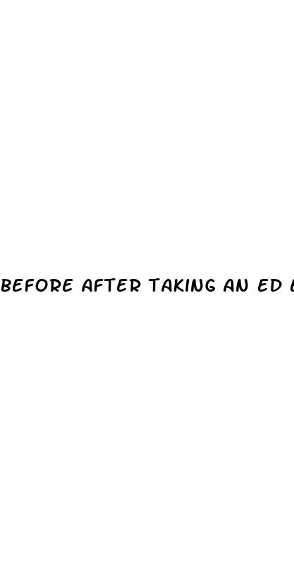 before after taking an ed erection pills