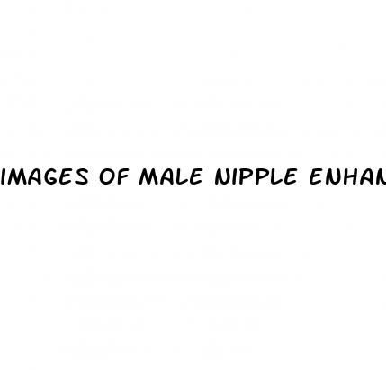 images of male nipple enhancement