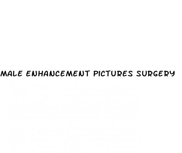 male enhancement pictures surgery