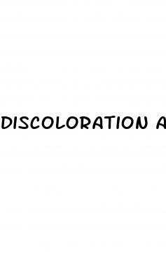 discoloration anus and erectile dysfunction