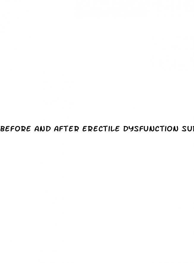 before and after erectile dysfunction surgery