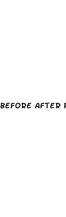 Before After Pics Weight Loss - How To Run A Weight Loss Support Group
