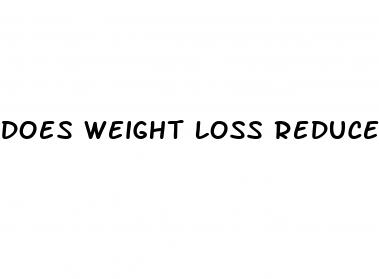Does Weight Loss Reduce Cholesterol - What Is A Plateau Weight Loss
 - ﻿Pendidikan