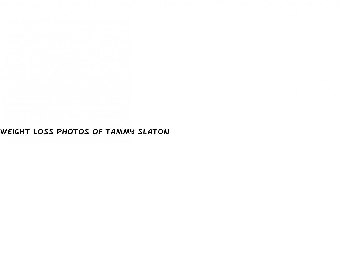 weight loss photos of tammy slaton