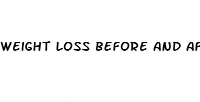weight loss before and after