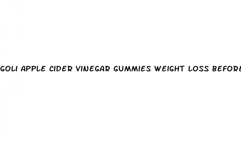 goli apple cider vinegar gummies weight loss before and after