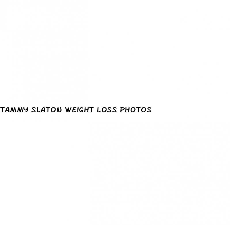 tammy slaton weight loss photos