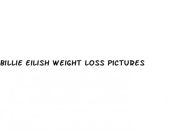 billie eilish weight loss pictures