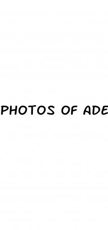 photos of adeles weight loss