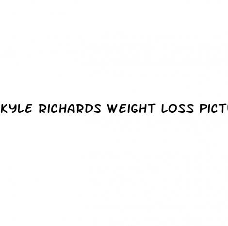 kyle richards weight loss pictures