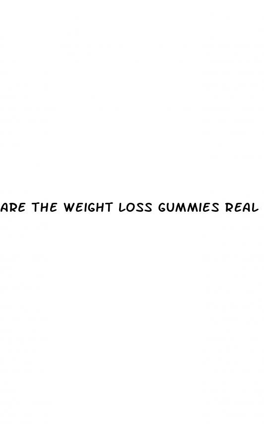 are the weight loss gummies real