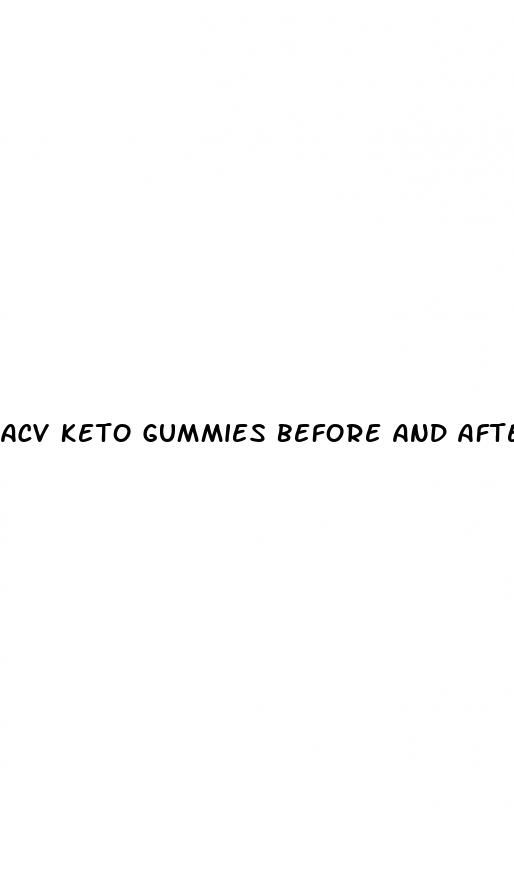 acv keto gummies before and after