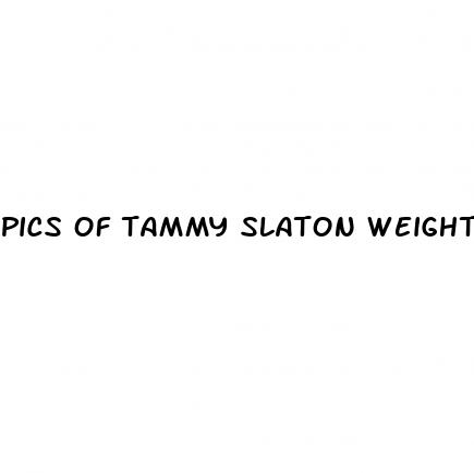 pics of tammy slaton weight loss