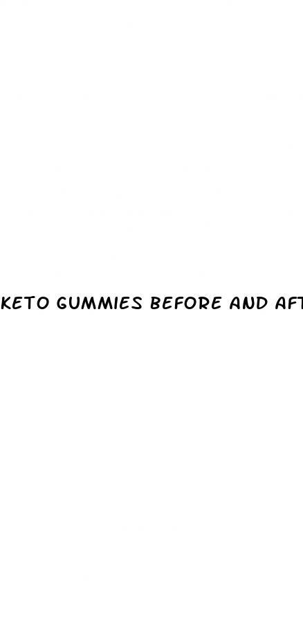 keto gummies before and after pictures