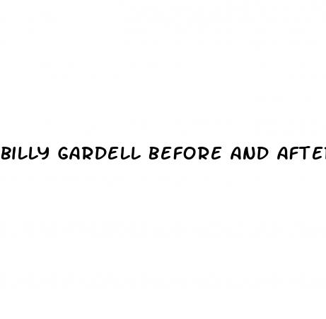 billy gardell before and after weight loss photos