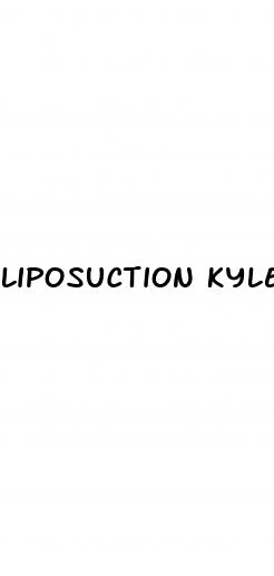 liposuction kyle richards weight loss