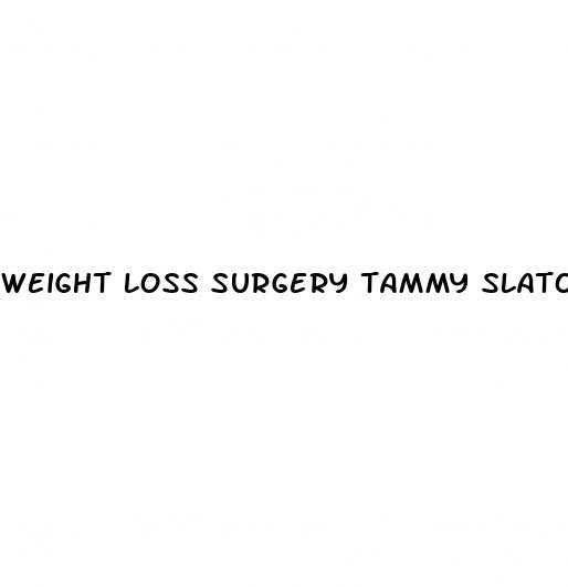weight loss surgery tammy slaton now