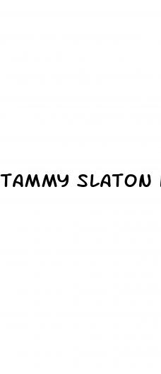 tammy slaton husband weight loss surgery