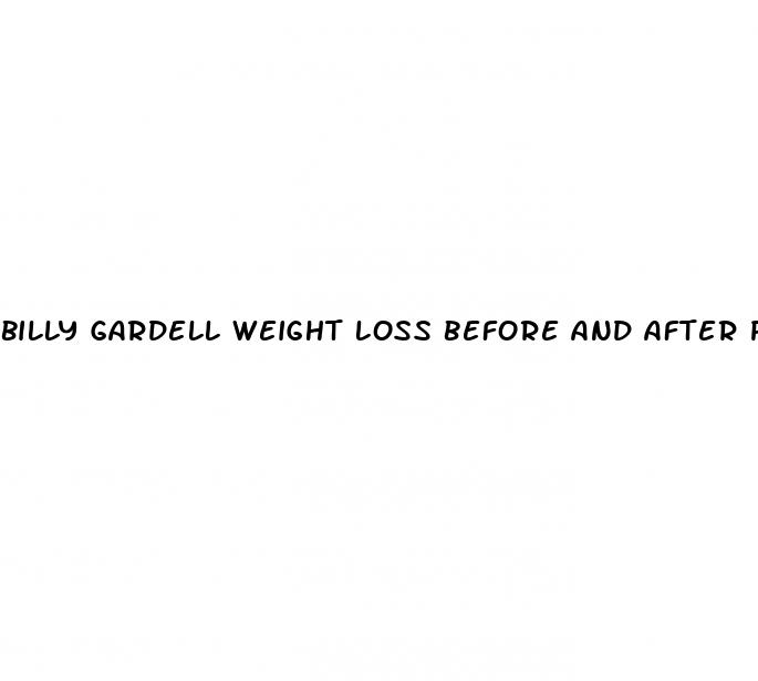 billy gardell weight loss before and after pictures