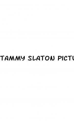 tammy slaton pictures after weight loss