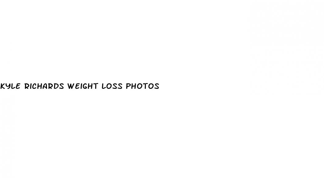 kyle richards weight loss photos