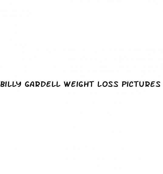 billy gardell weight loss pictures