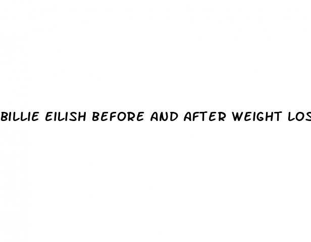 billie eilish before and after weight loss