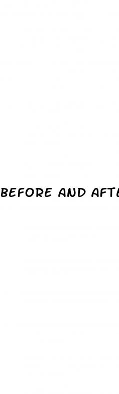 before and after effects of erectile dysfunction medications