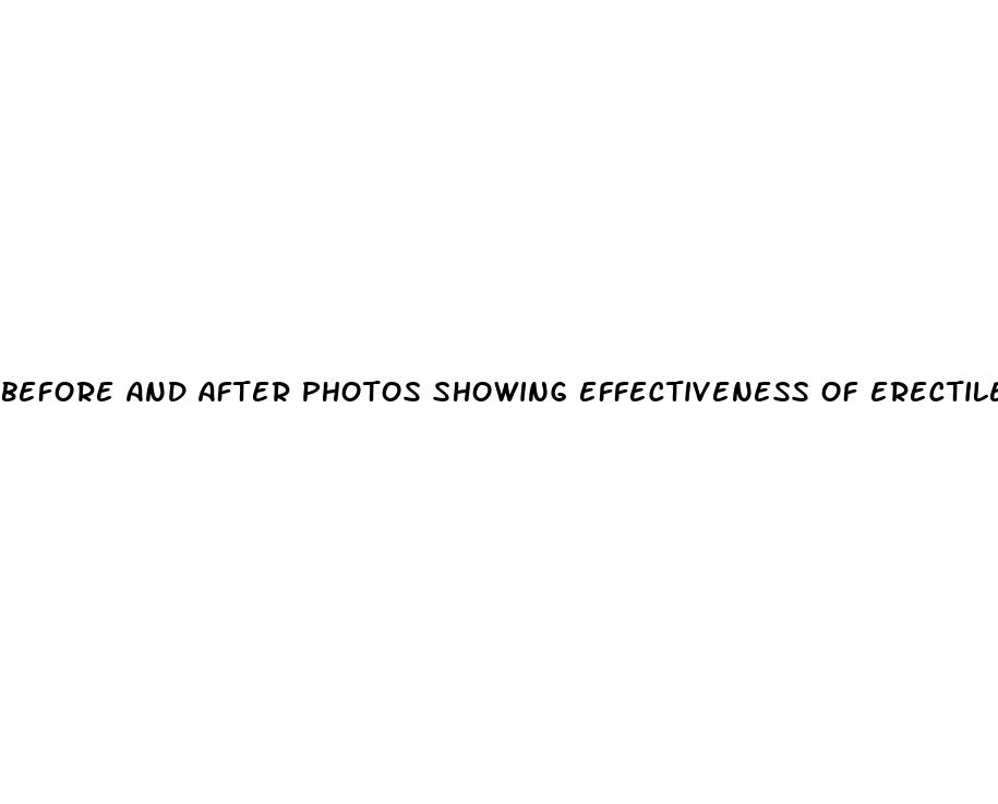 before and after photos showing effectiveness of erectile dysfunction