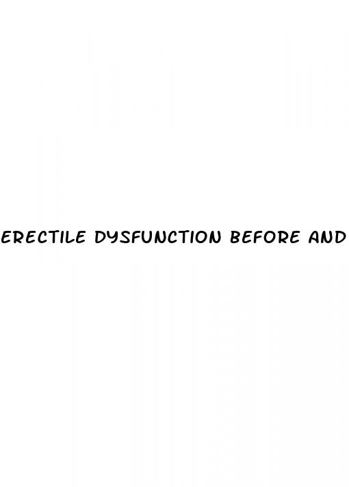 erectile dysfunction before and after x photos