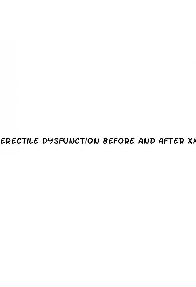 erectile dysfunction before and after xxx photos