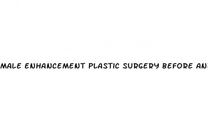 male enhancement plastic surgery before and after video