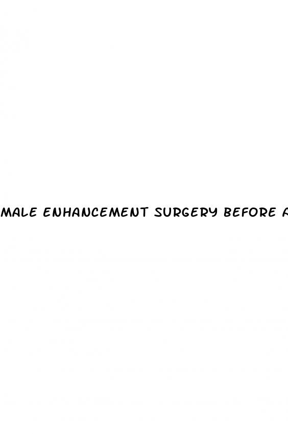 male enhancement surgery before and after