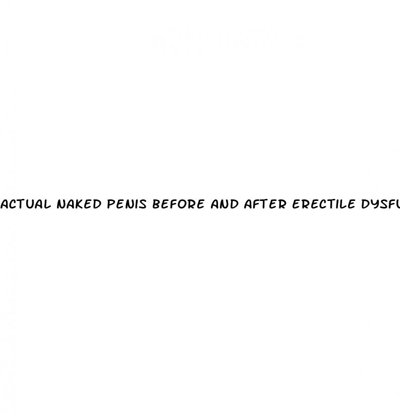 actual naked penis before and after erectile dysfunction drugs