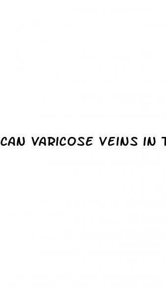 can varicose veins in the testicles cause erectile dysfunction
